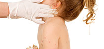 Rashes in Toddlers