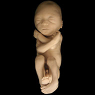 Fetal Development Week 41