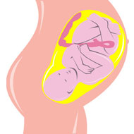 Pregnancy Placenta Previa