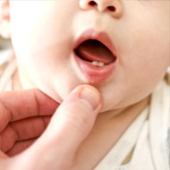 Toddler Tooth Extraction
