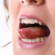 Mouth Sores During Pregnancy