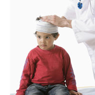 Skull Fracture In Toddlers