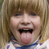 Tongue Blisters In Toddlers